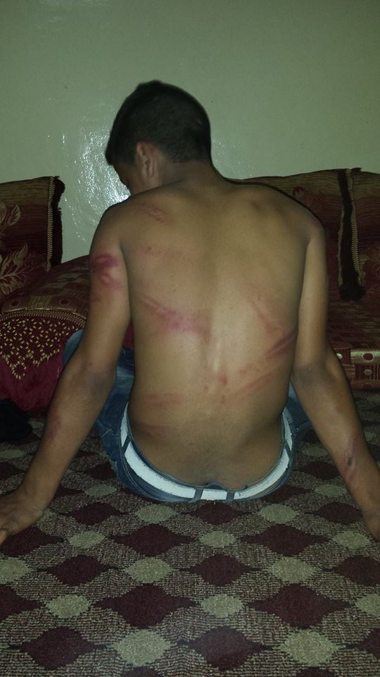 Ayub Garmat 16 year old brutally attacked by Moroccan police. Image by AdalaUK membres.